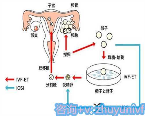 新生儿黄疸的警示：健康隐患不容忽视